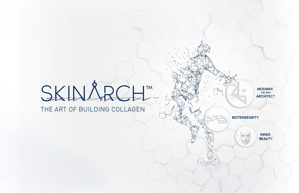 Skinarch